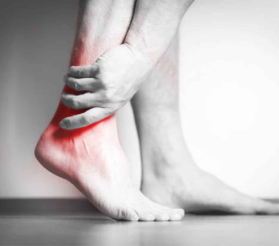 Intermetatarsal Bursitis - Ankle, Foot and Orthotic Centre